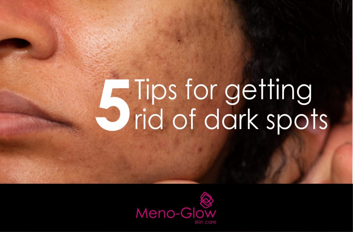 5 tips for preventing and treating dark spots